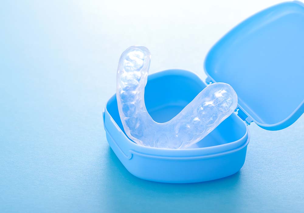 マウスピース製作